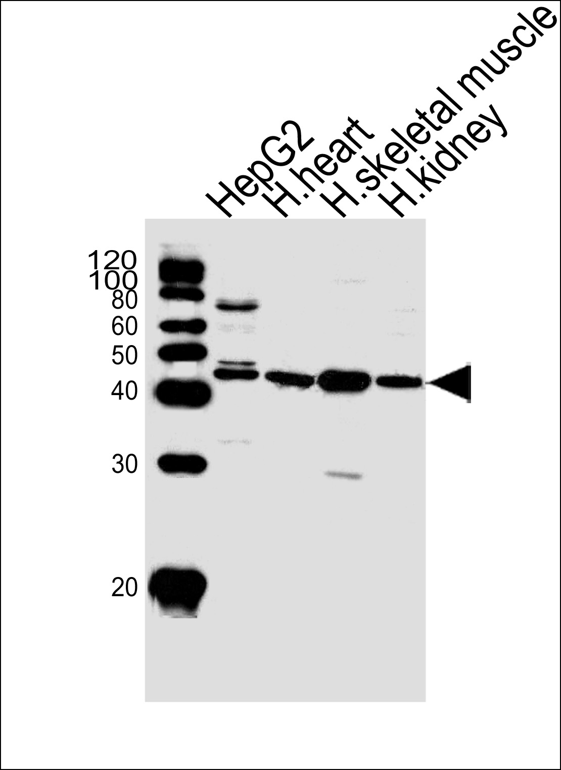 Rabbit Polyclonal Antibody to SPHK1 (N-term P74)
