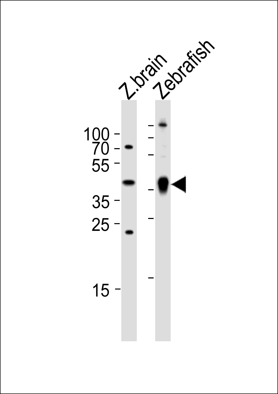 Rabbit Polyclonal Antibody to (DANRE) ada