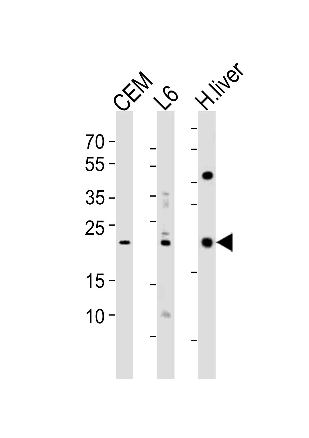 Rabbit Polyclonal Antibody to PEMT (N-term)