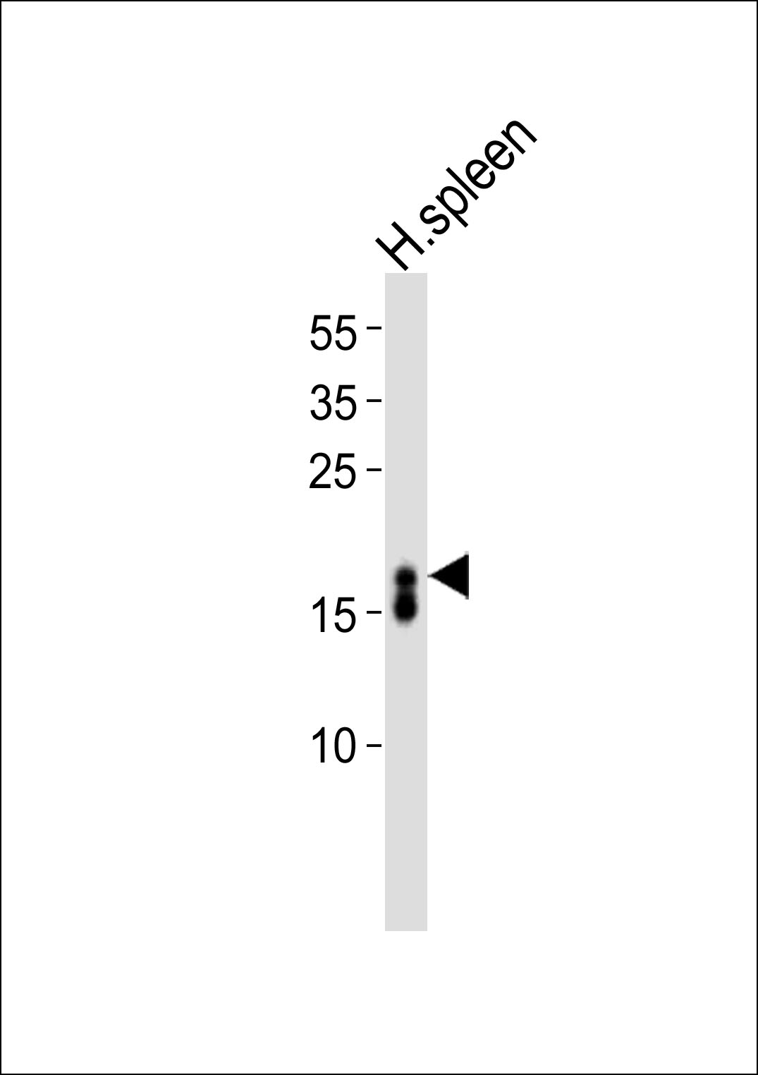 Rabbit Polyclonal Antibody to RNASE3