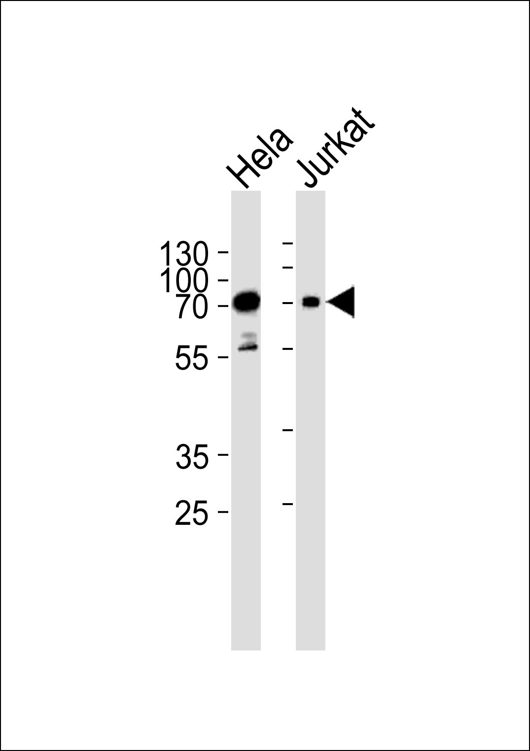Rabbit Polyclonal Antibody to Mouse Pak3 (N-term)