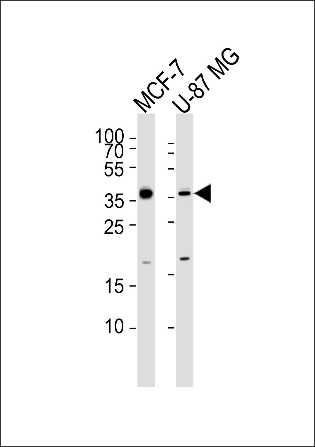 Rabbit Polyclonal Antibody to KCTD4