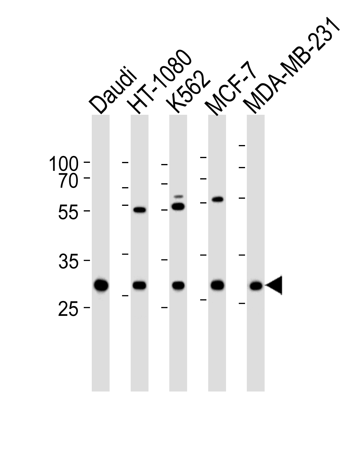 Rabbit Polyclonal Antibody to PNP