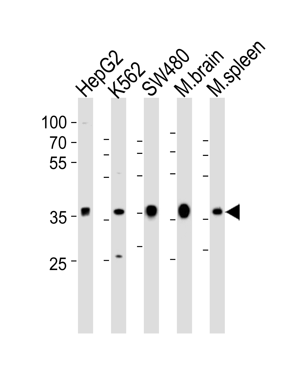 Rabbit Polyclonal Antibody to NAPG