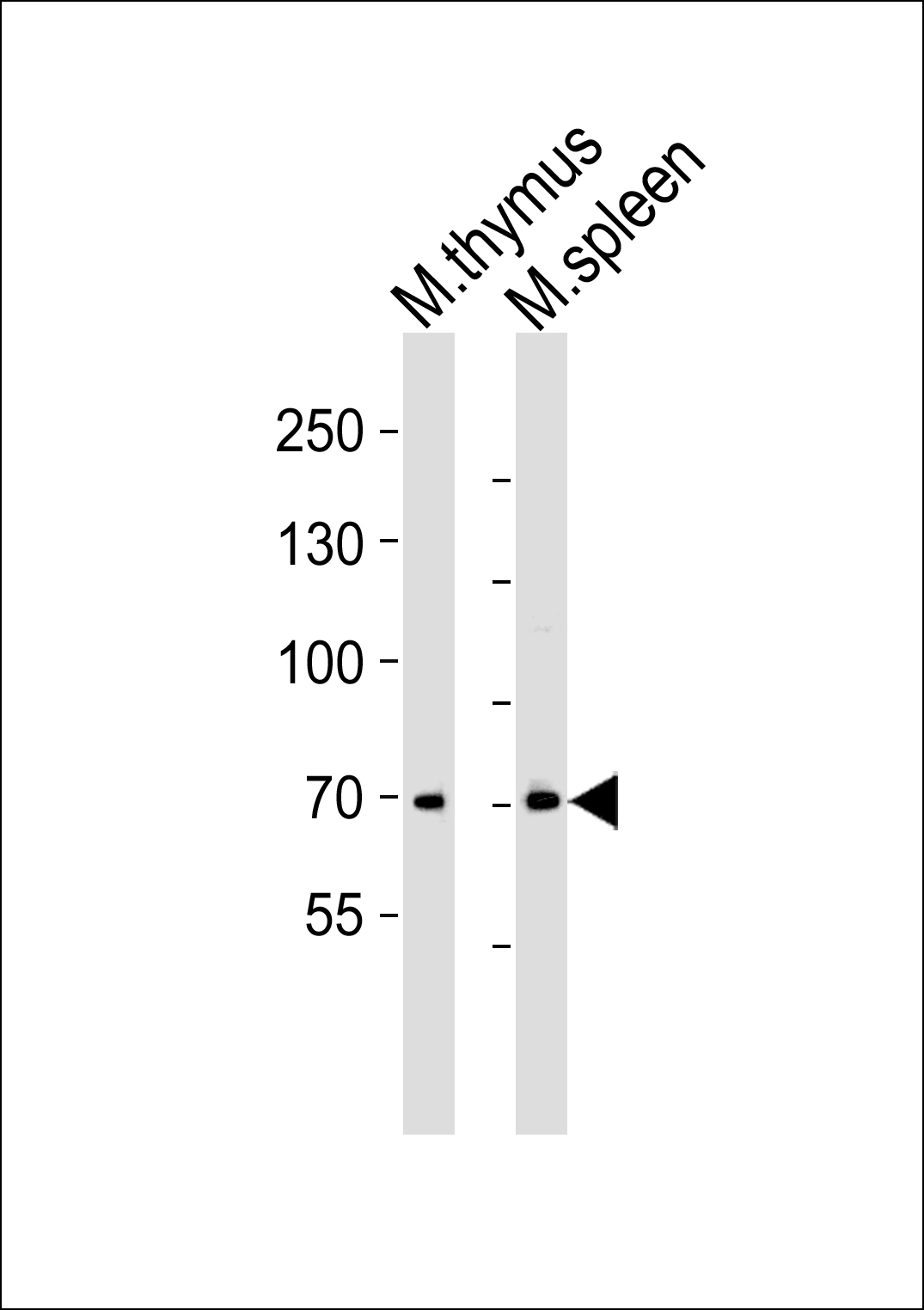 Rabbit Polyclonal Antibody to Mouse Itk (N-term)