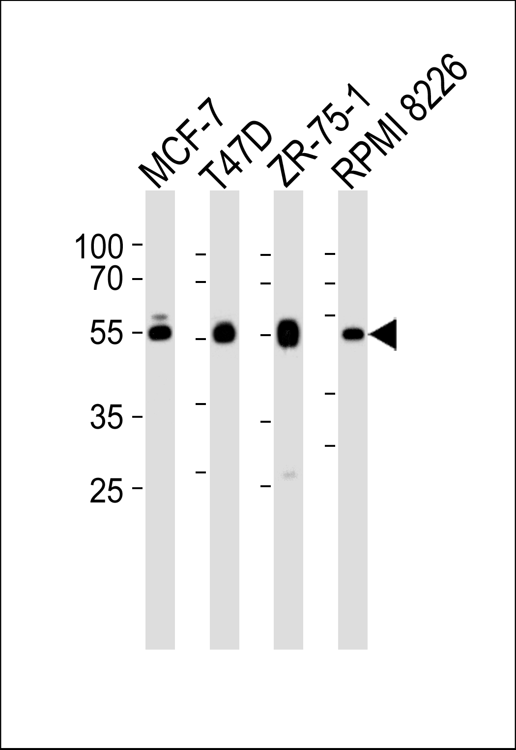 Rabbit Polyclonal Antibody to ZDHHC11