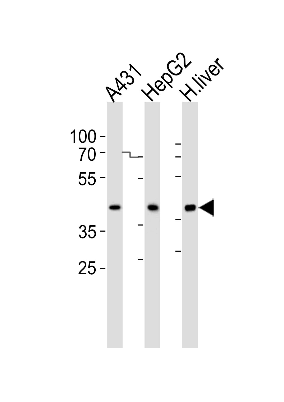 Rabbit Polyclonal Antibody to ACADSB