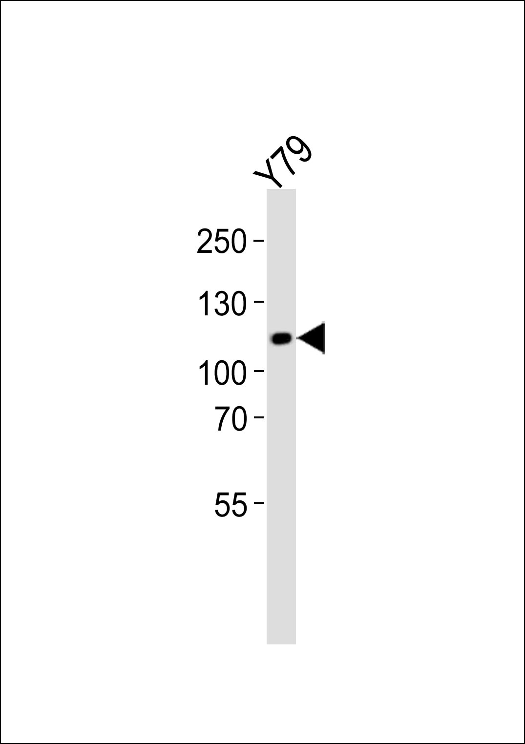 Rabbit Polyclonal Antibody to ANKRD24