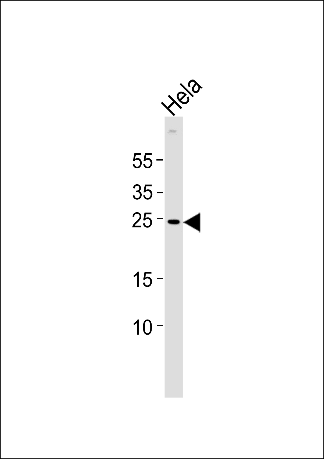 Rabbit Polyclonal Antibody to ZNRF2 (N-term)