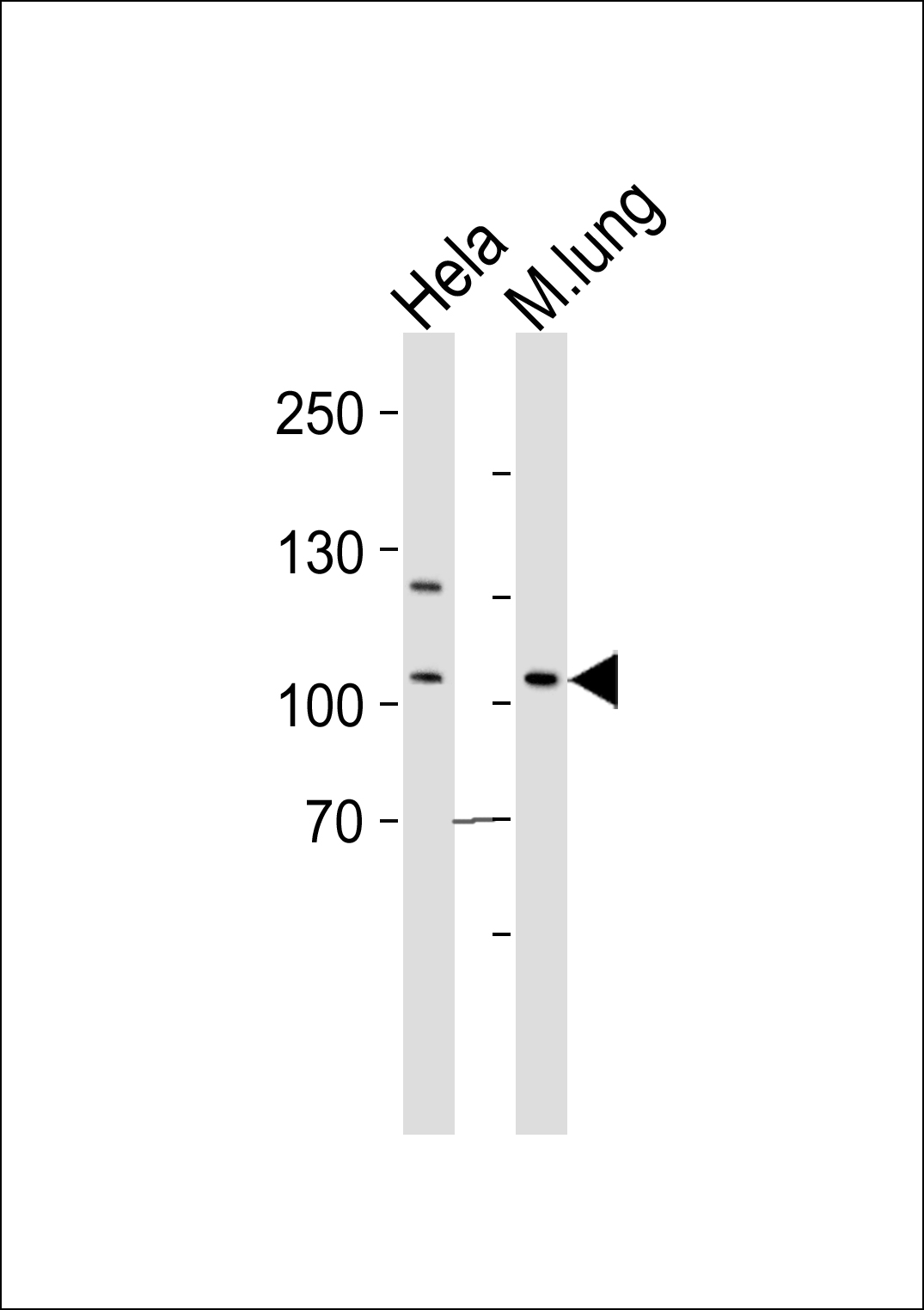 Rabbit Polyclonal Antibody to Mouse Epha4
