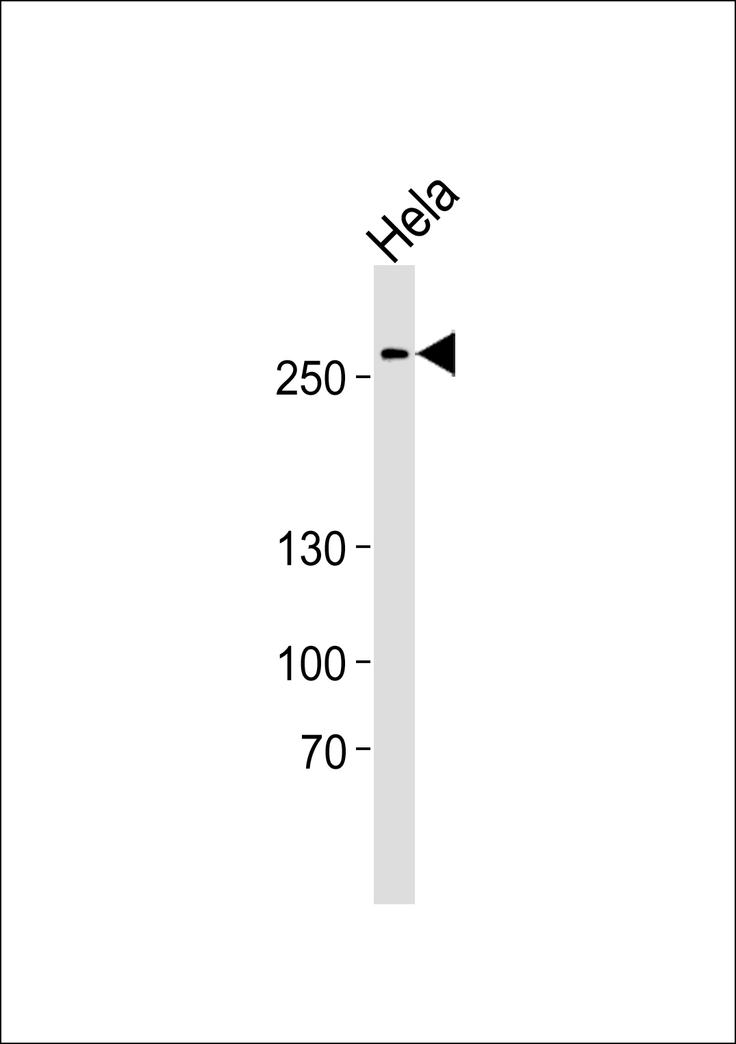 Rabbit Polyclonal Antibody to Human-AHCTF1 (S1232)