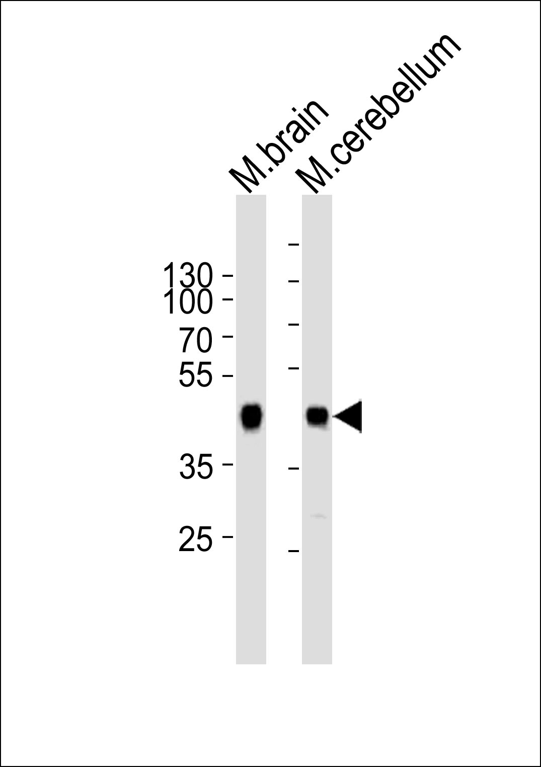 Rabbit Polyclonal Antibody to ZDHHC14
