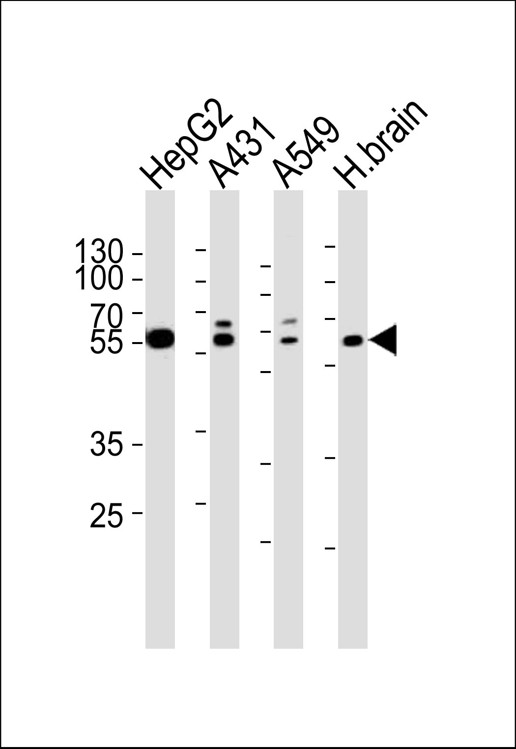 Rabbit Polyclonal Antibody to SERAC1 (N-term)