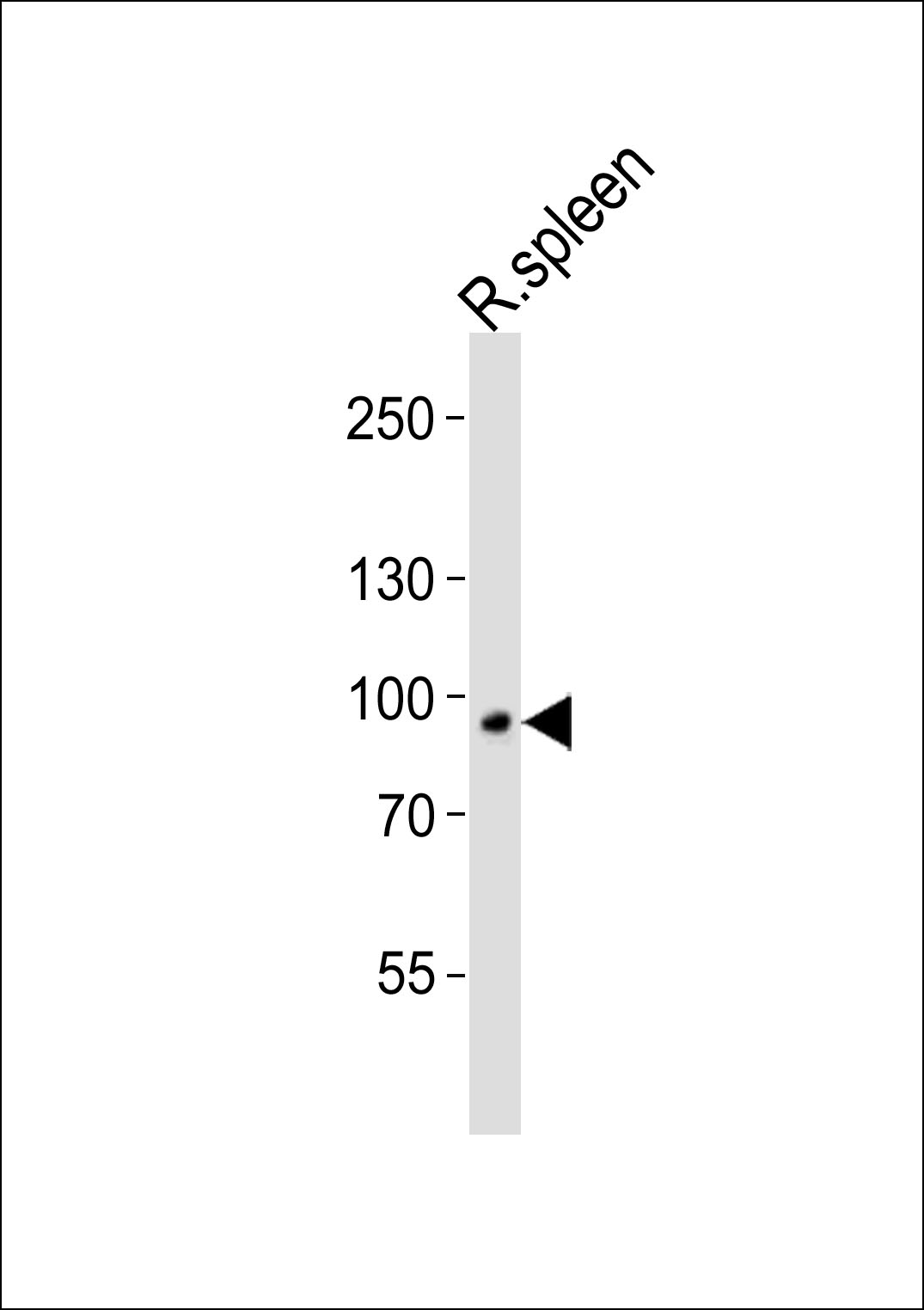 Rabbit Polyclonal Antibody to VAC14