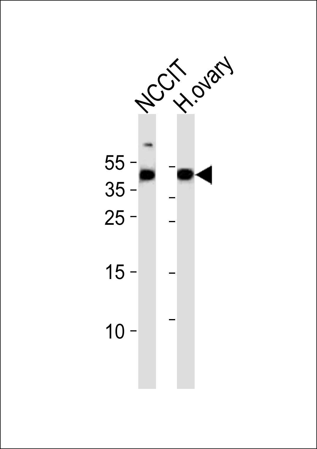 Rabbit Polyclonal Antibody to HESRG