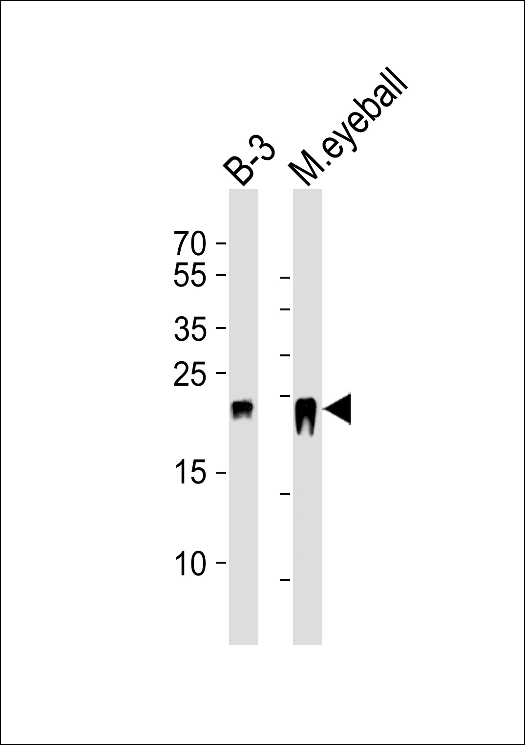 Rabbit Polyclonal Antibody to CRYBB2 (N-term)