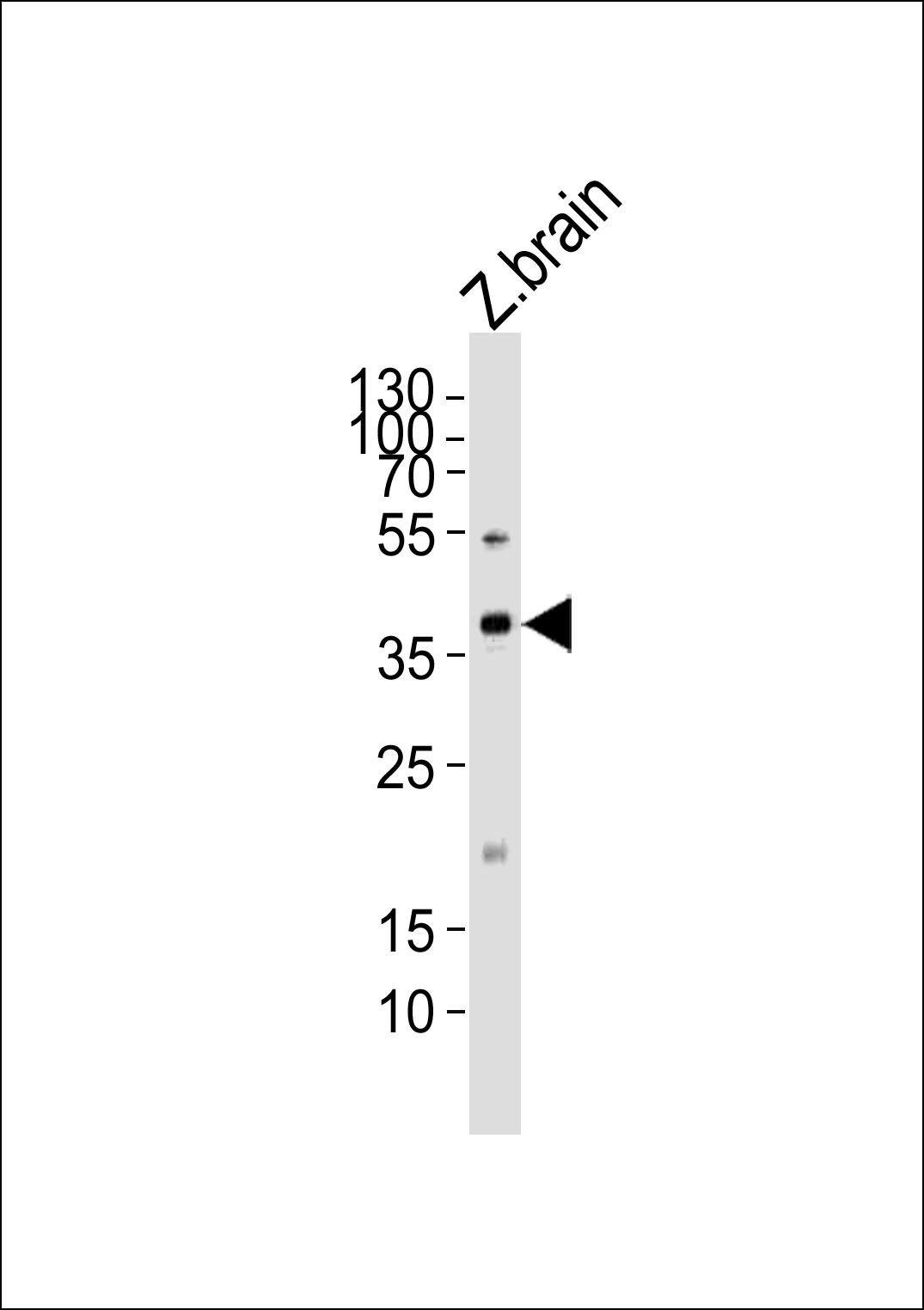Rabbit Polyclonal Antibody to (DANRE) mab21l2