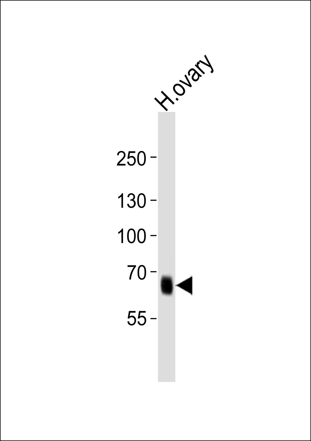 Rabbit Polyclonal Antibody to PRDM13 (N-term)