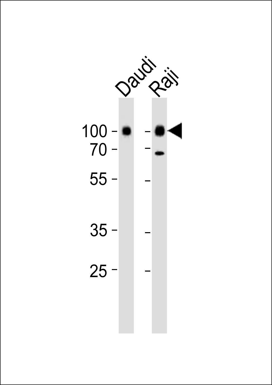 Rabbit Polyclonal Antibody to CD19
