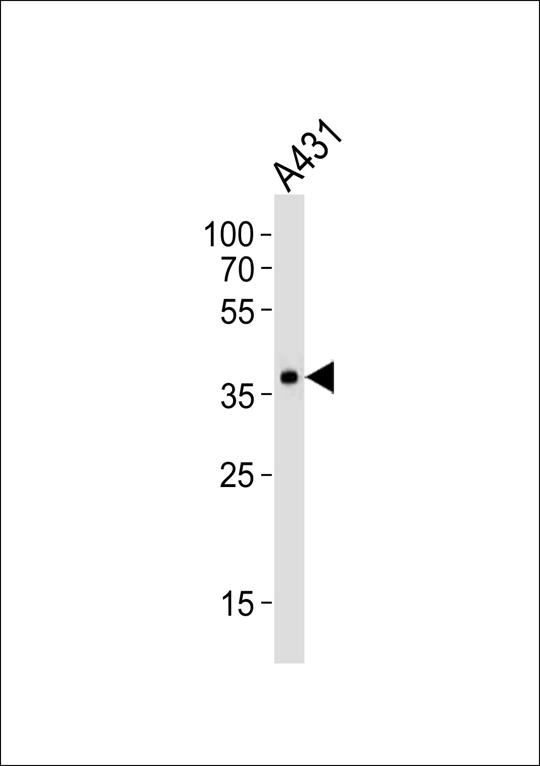 Rabbit Polyclonal Antibody to MUL1