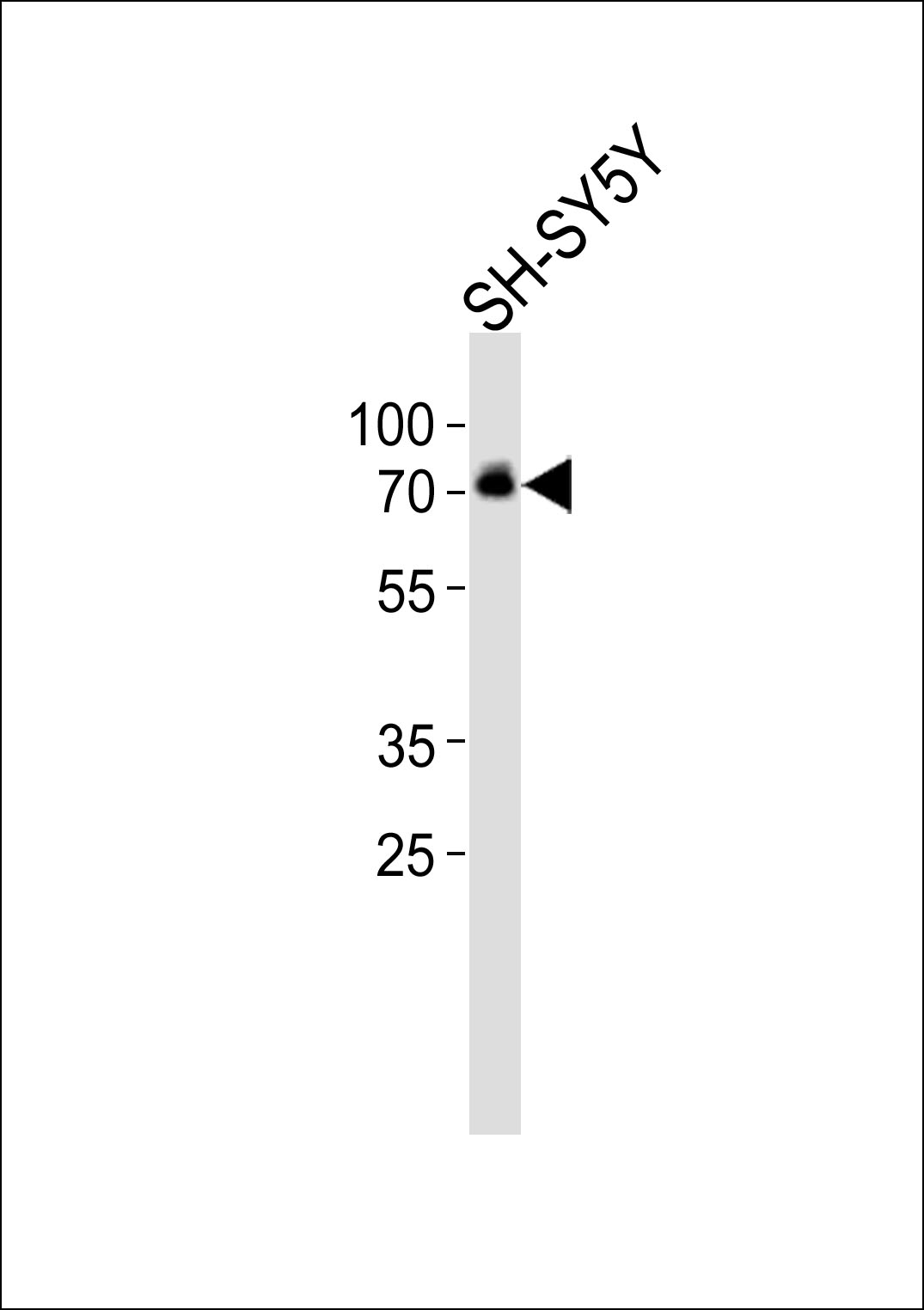 Rabbit Polyclonal Antibody to DBH