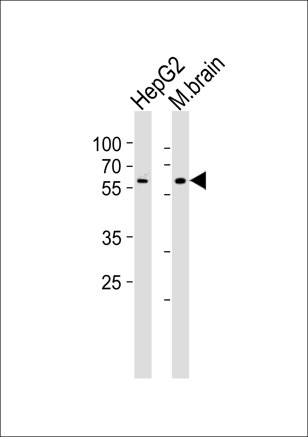 Rabbit Polyclonal Antibody to GLD2 (N-term)