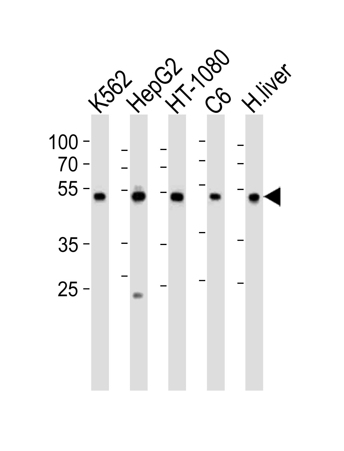 Rabbit Polyclonal Antibody to PDIA6 (Center K159)