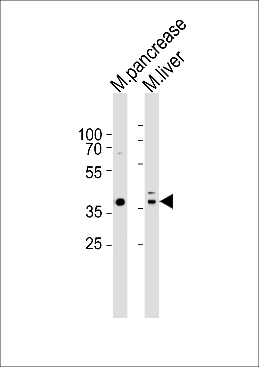 Rabbit Polyclonal Antibody to Mouse Hmx3