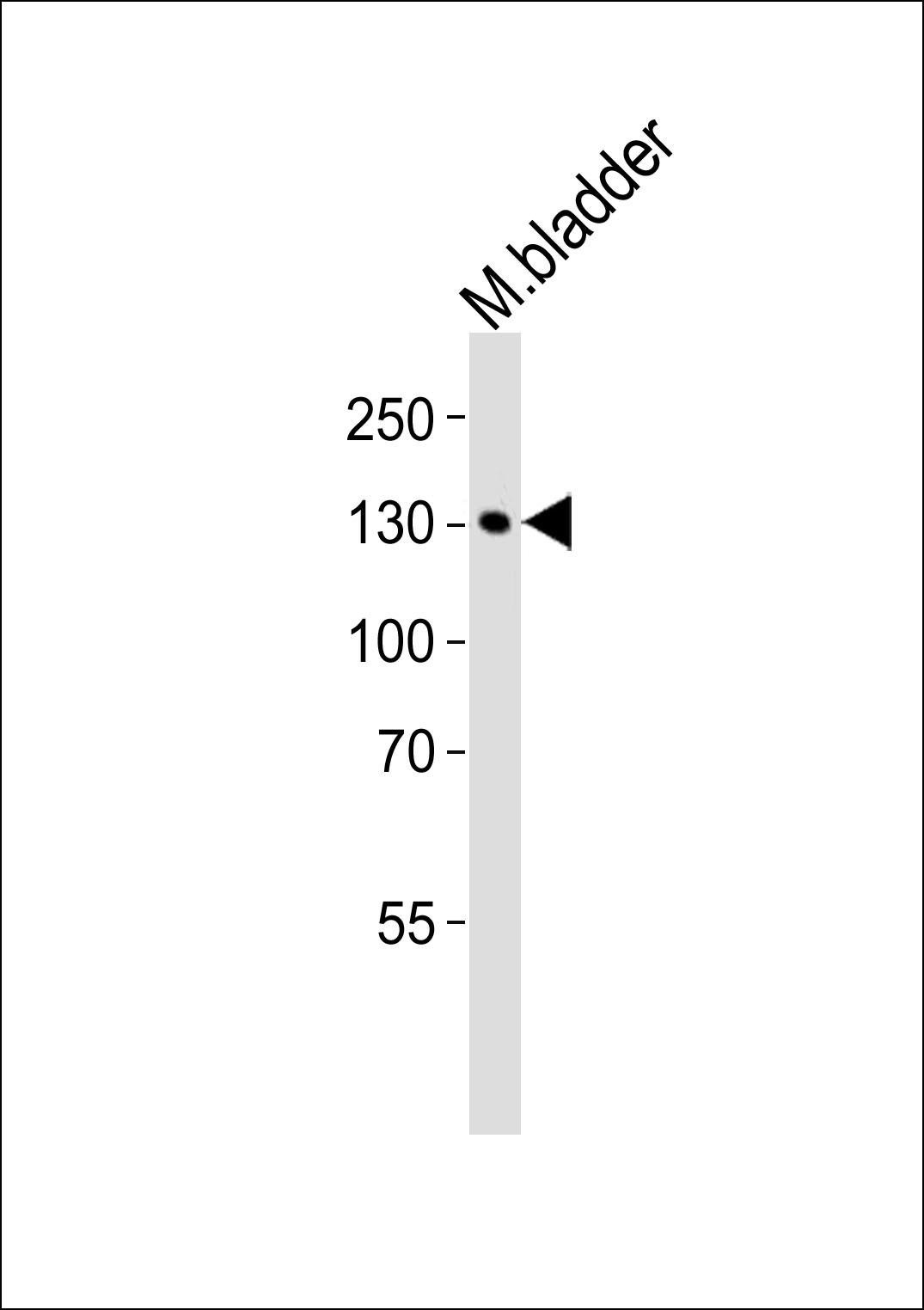 Rabbit Polyclonal Antibody to MLCK (N-term)