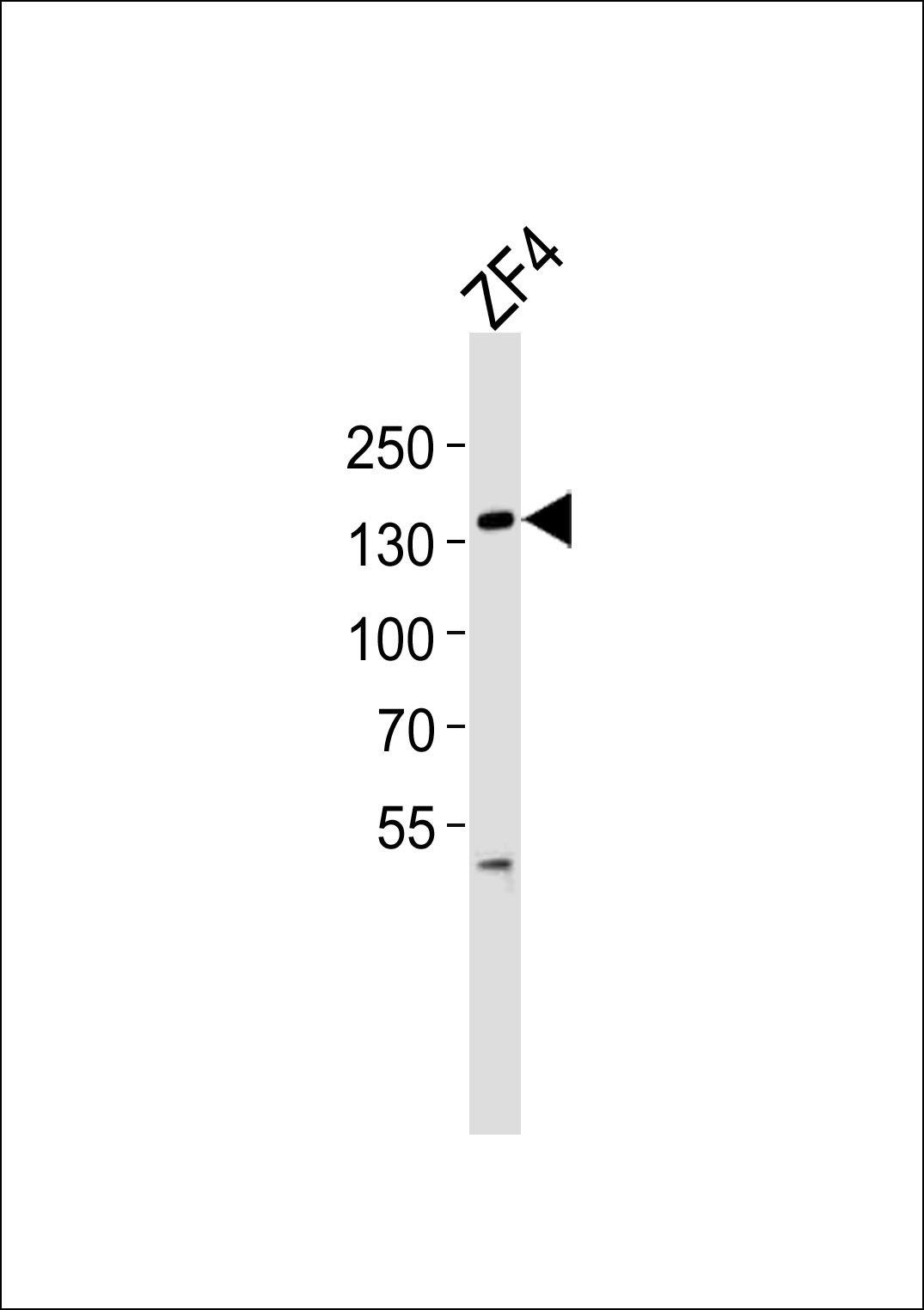 Rabbit Polyclonal Antibody to (DANRE) pkn2  (N-term)