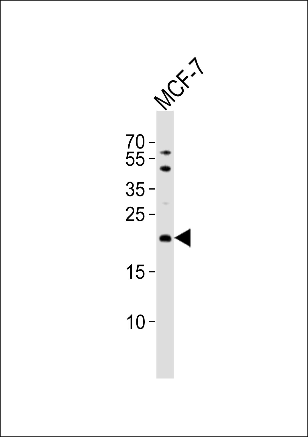 Rabbit Polyclonal Antibody to TIMM23