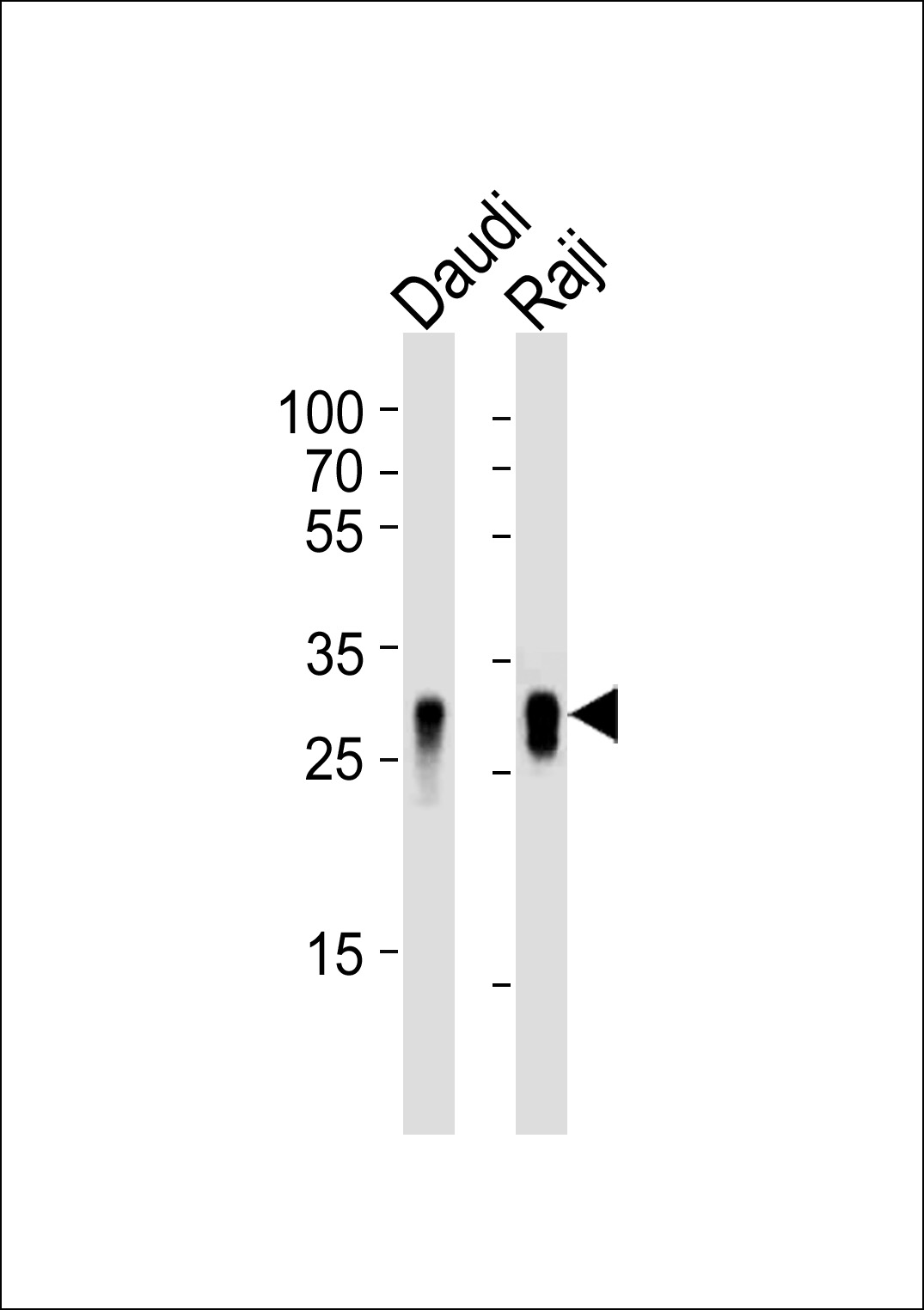 Rabbit Polyclonal Antibody to HLA-DRB1
