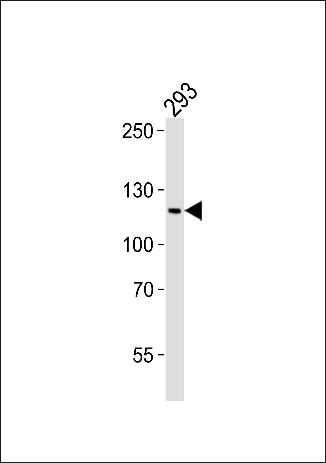 Rabbit Polyclonal Antibody to PAXIP1 (N-term)