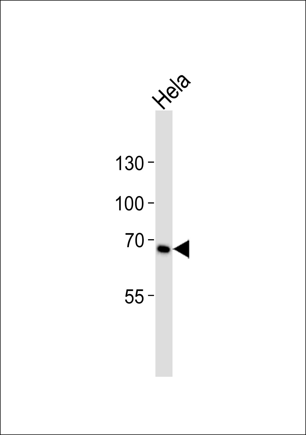 Rabbit Polyclonal Antibody to TNFRSF8 (N-term)