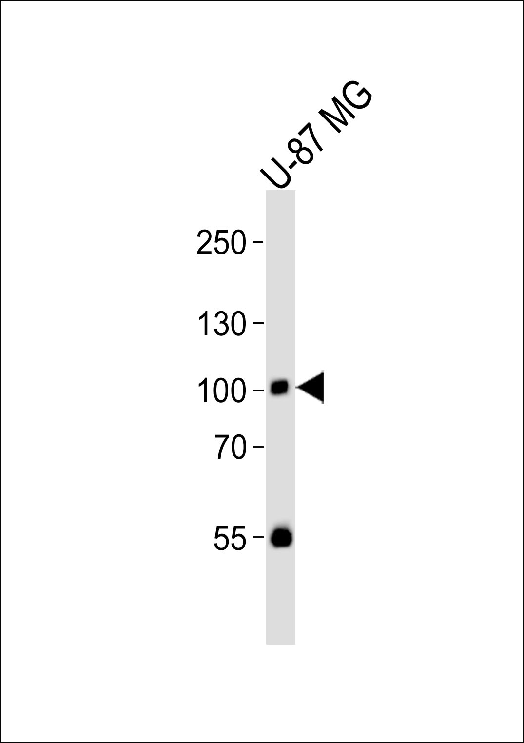 Rabbit Polyclonal Antibody to HUMAN-RIN1(Y36)