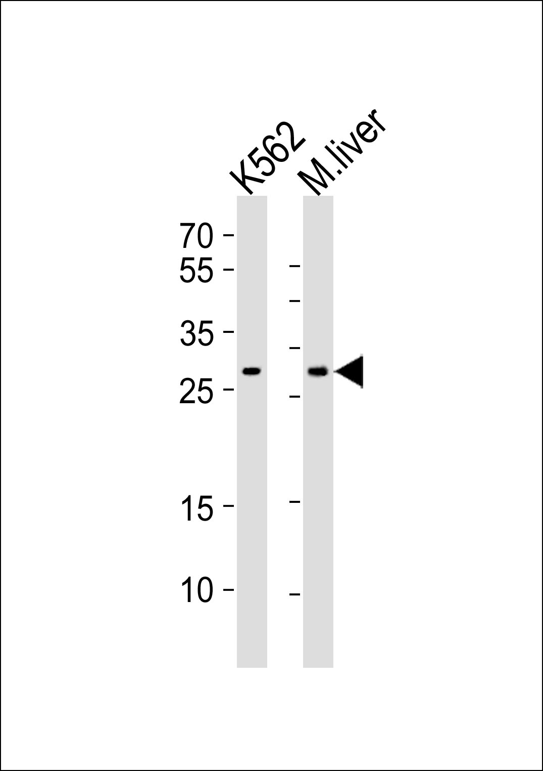 Rabbit Polyclonal Antibody to CYB5R2 (N-term)