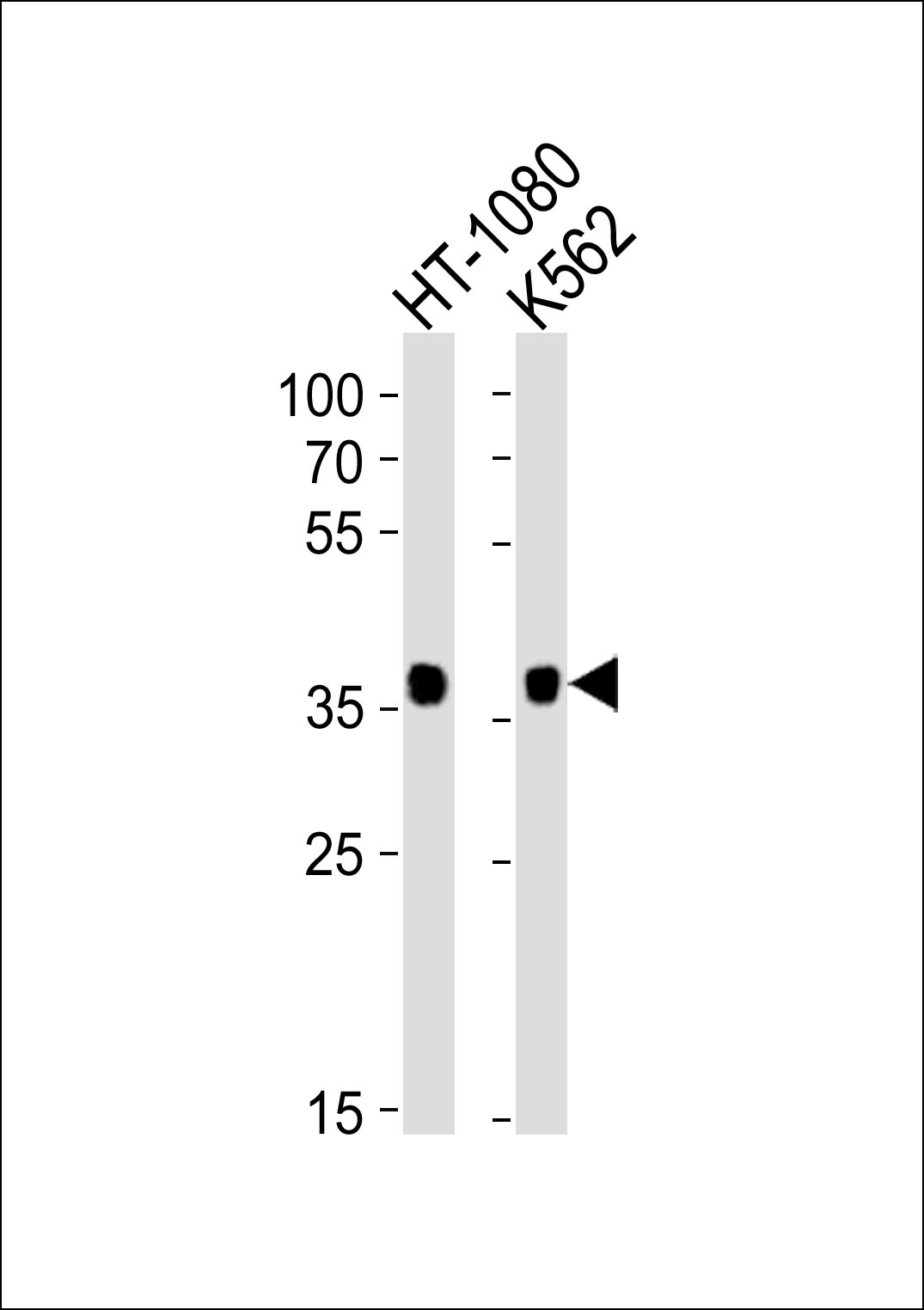 Rabbit Polyclonal Antibody to MRGPRX3 (N-term)