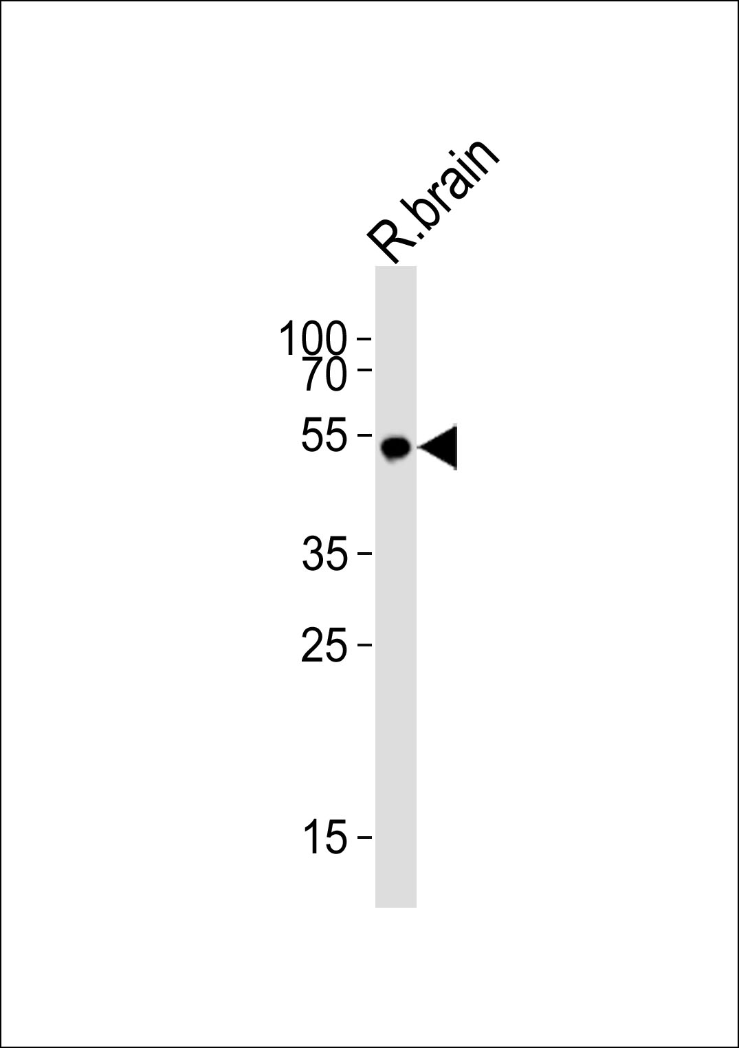 Rabbit Polyclonal Antibody to KCNJ16