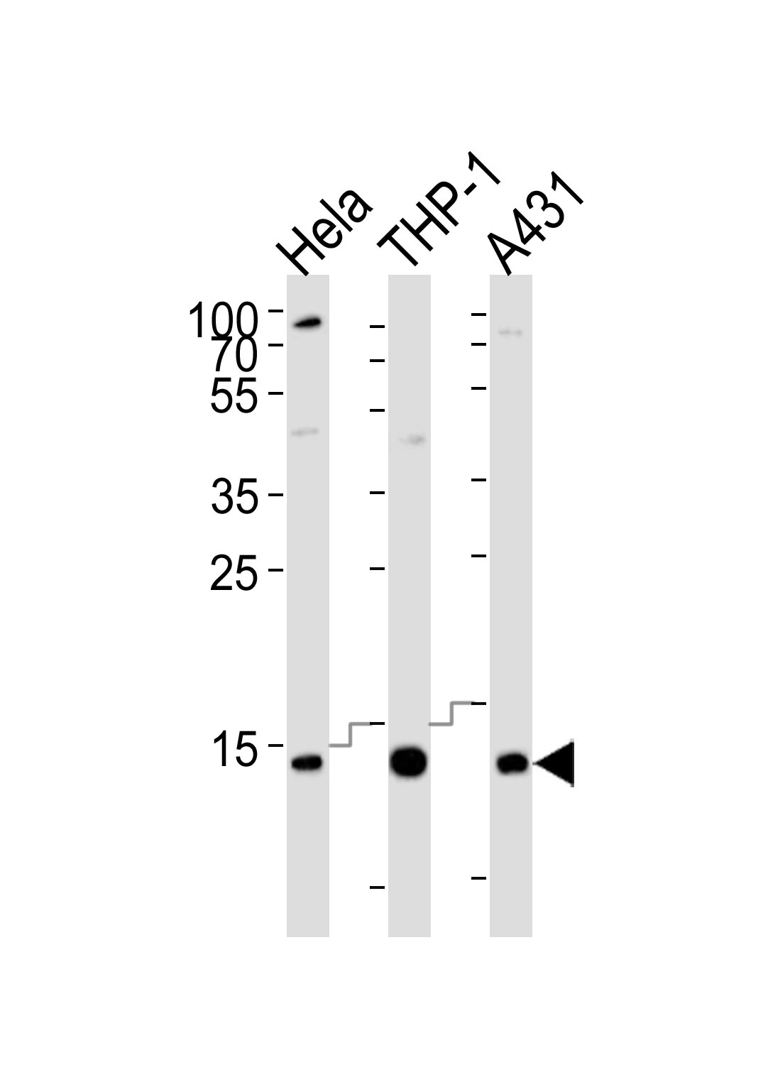 Mouse Monoclonal Antibody to VAMP8 (N-term)