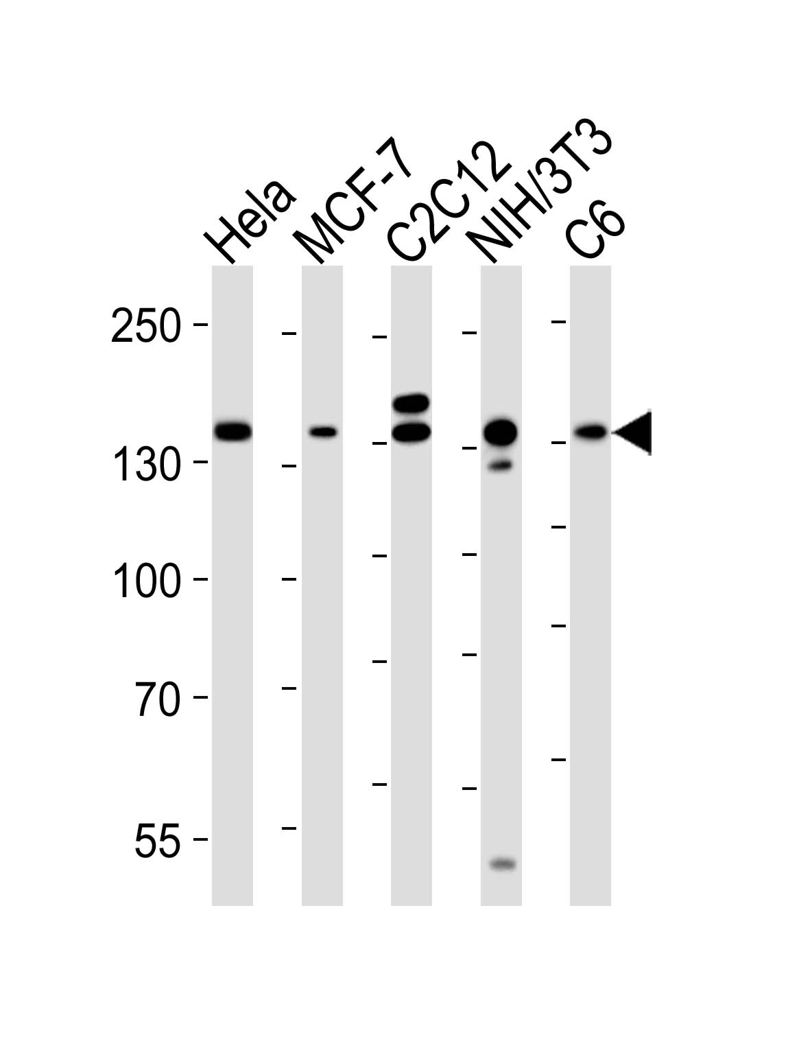 Mouse Monoclonal Antibody to RPTOR