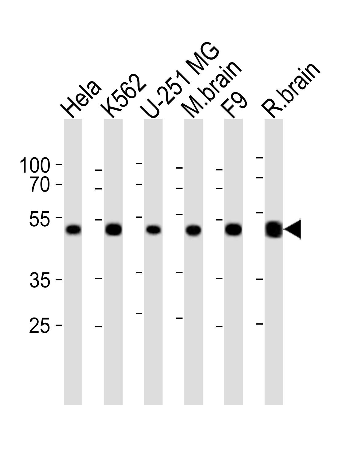 Rabbit Polyclonal Antibody to COPS2 (N-term)
