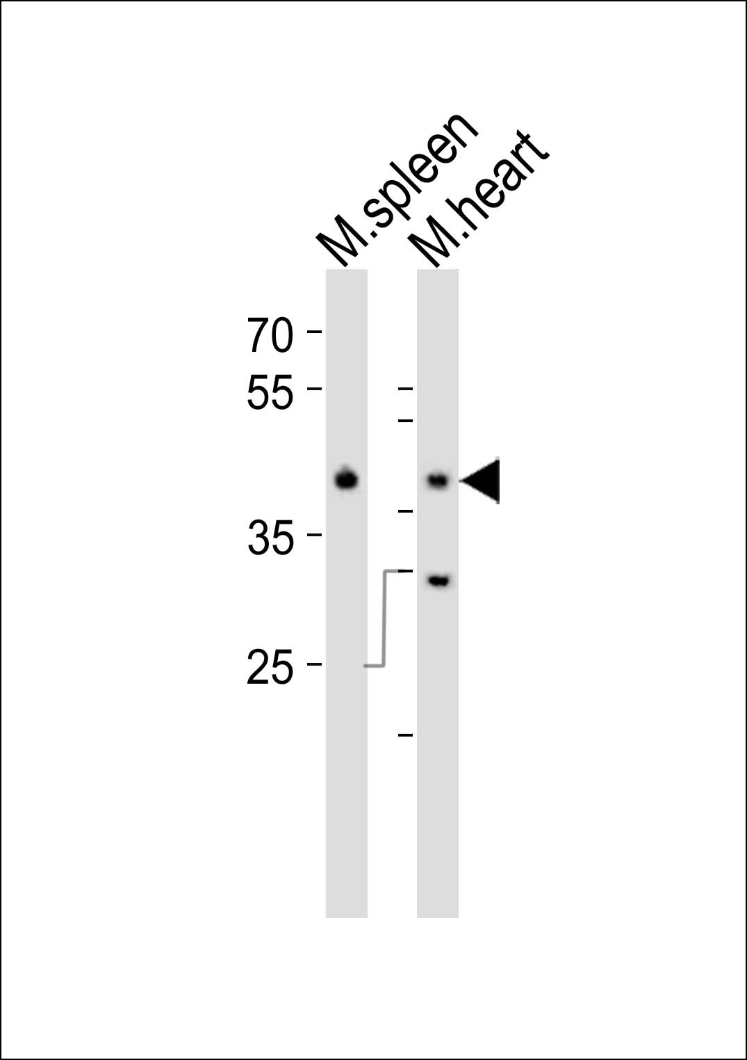 Rabbit Polyclonal Antibody to Mouse Mapk11 (N-term)