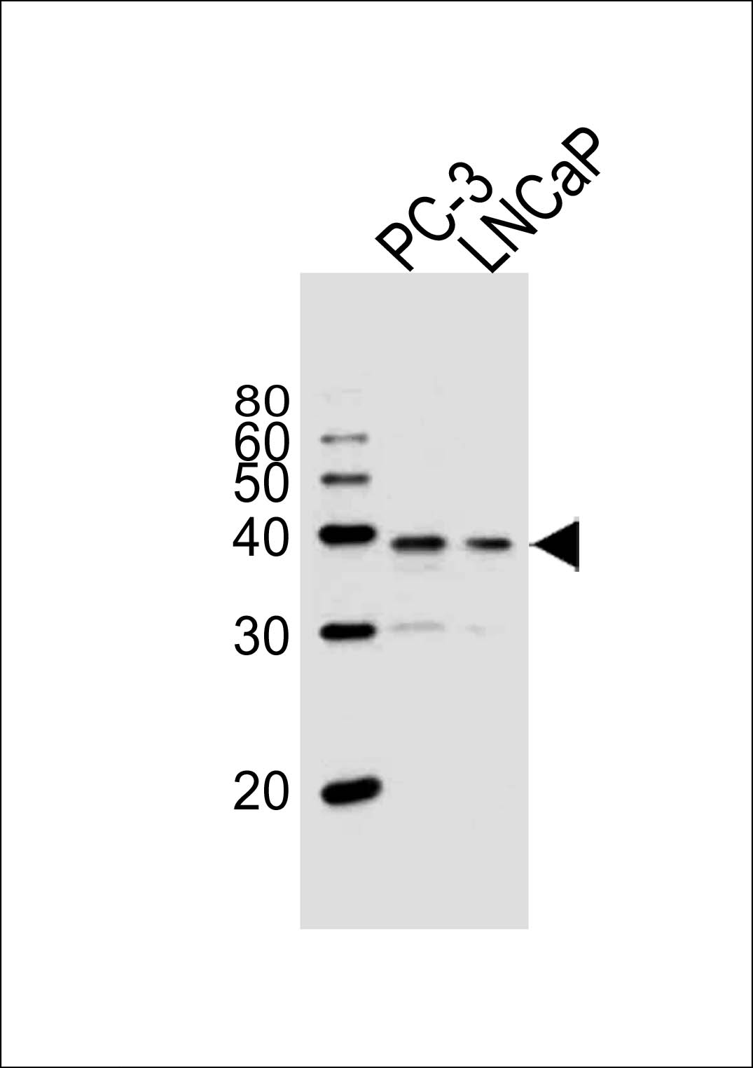 Rabbit Polyclonal Antibody to VDR