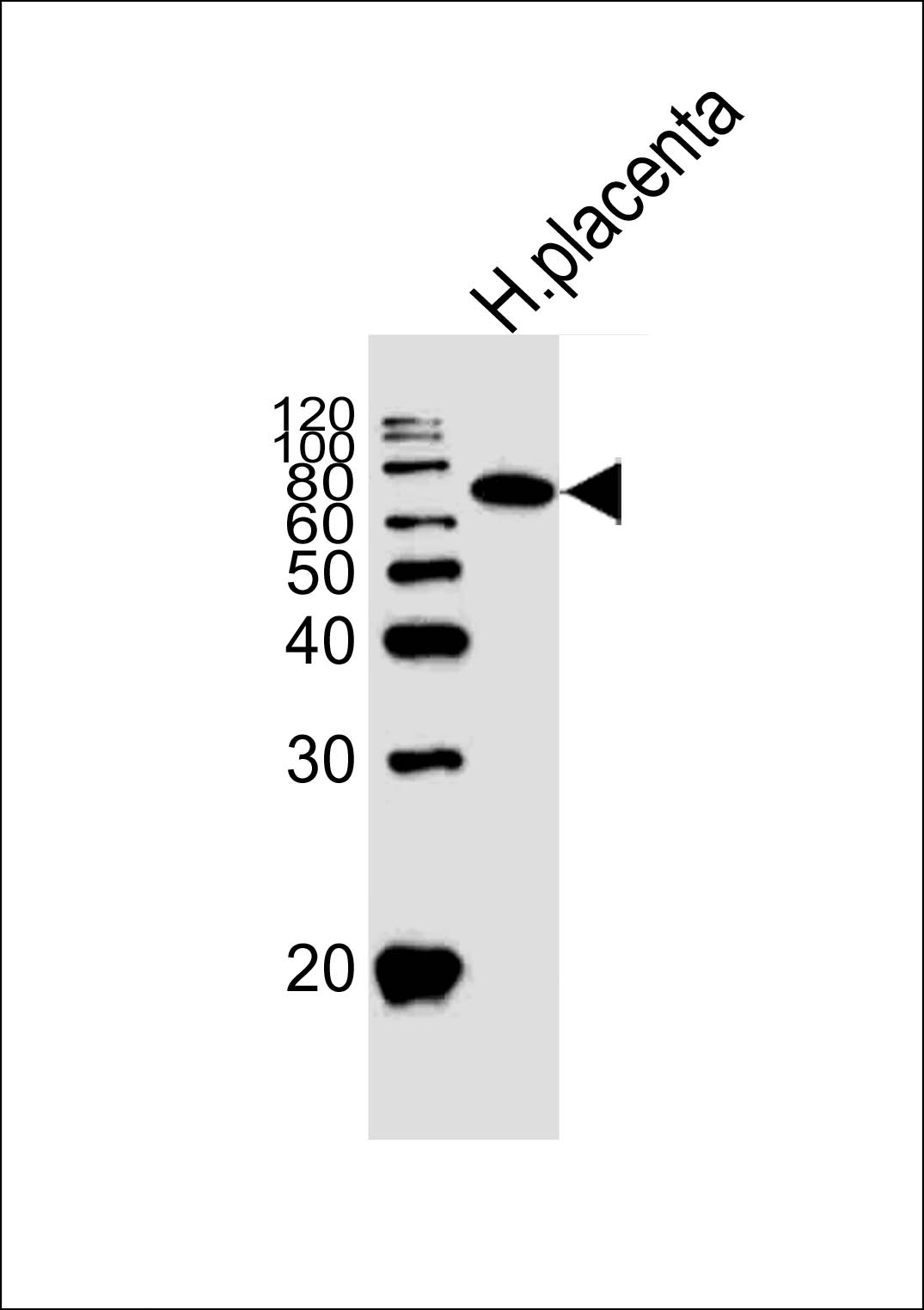 Rabbit Polyclonal Antibody to Alkaline Phosphatase (ALPI)