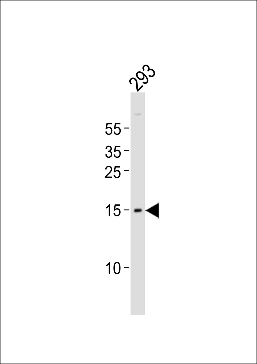 Rabbit Polyclonal Antibody to BATF (N-term)