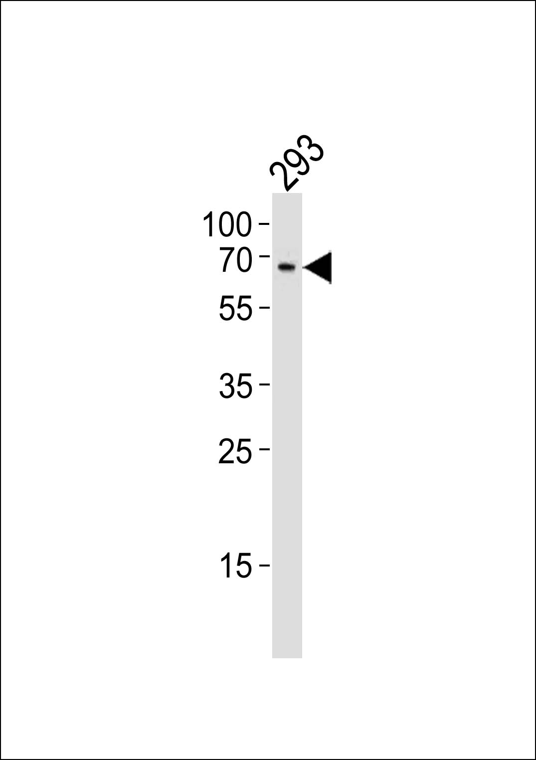 Rabbit Polyclonal Antibody to TESK1