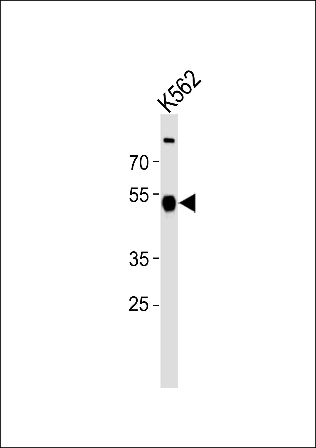 Rabbit Polyclonal Antibody to ZNF500 (N-term)