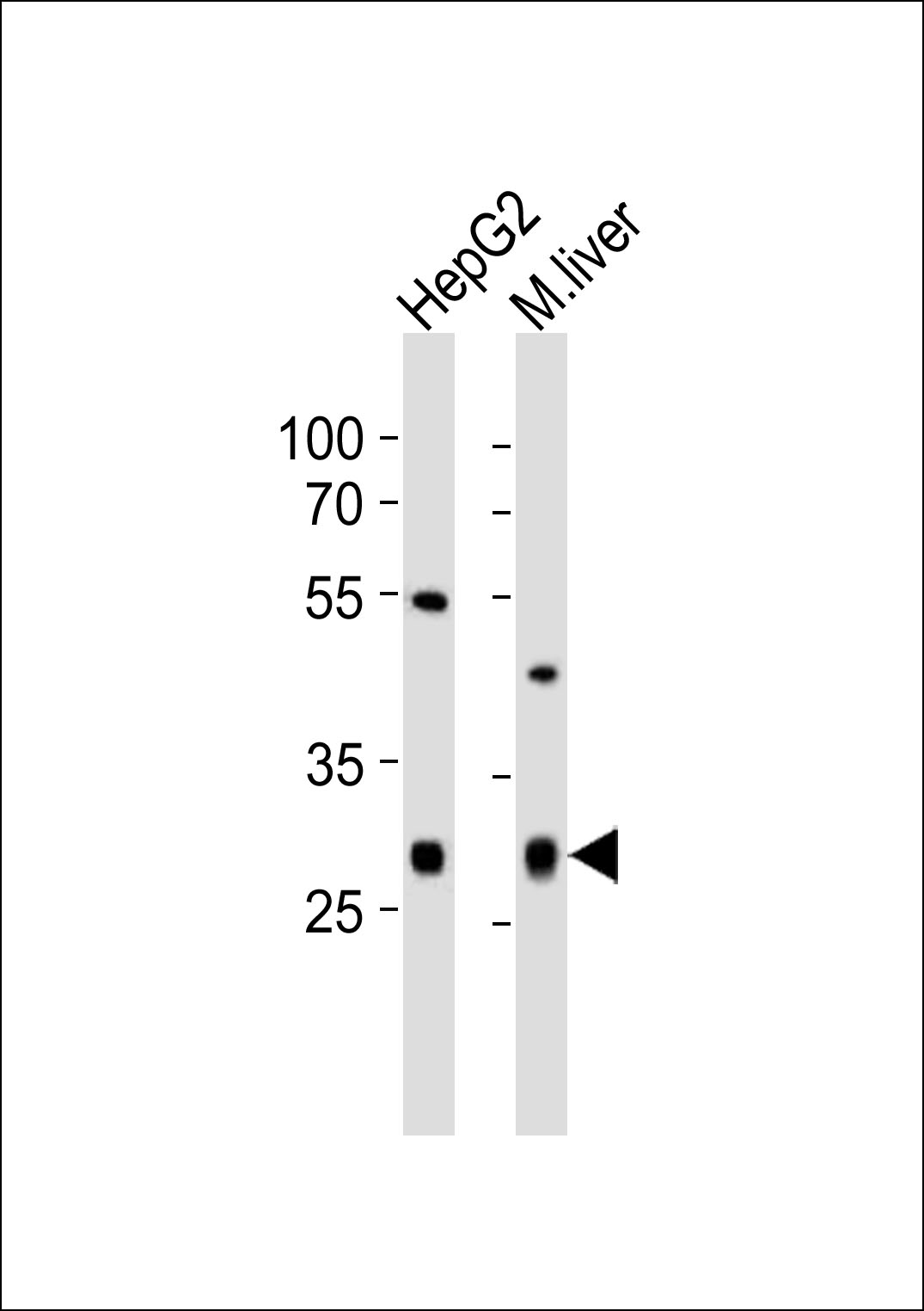 Rabbit Polyclonal Antibody to CTDSP1 (N-term)