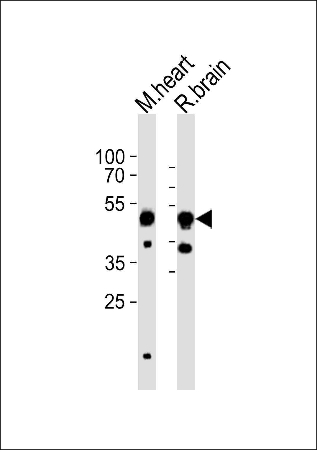 Rabbit Polyclonal Antibody to CHRNB3