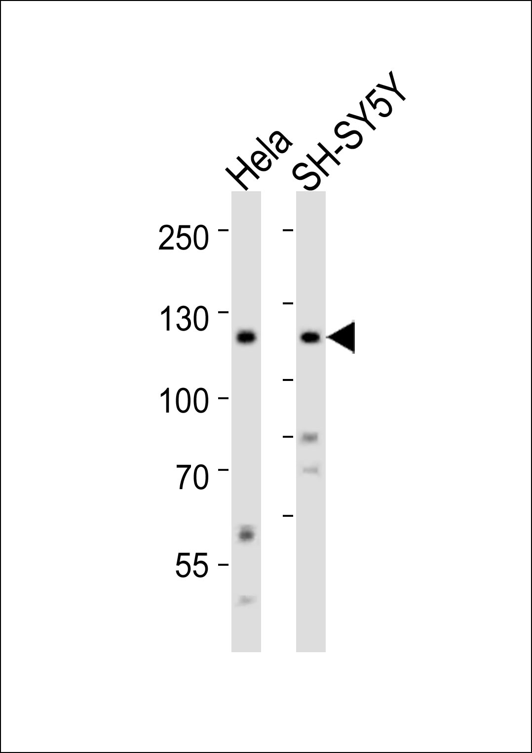 Rabbit Polyclonal Antibody to Mouse Ror2